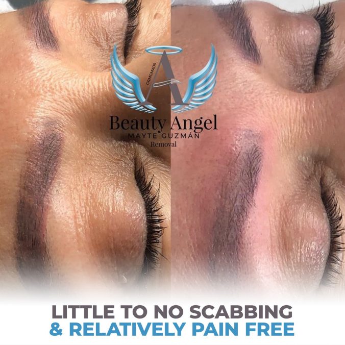 removal-4-676x676-1 removal-4-676x676-1