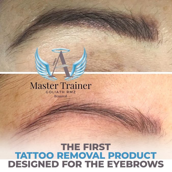 removal1-676x676-1 removal1-676x676-1